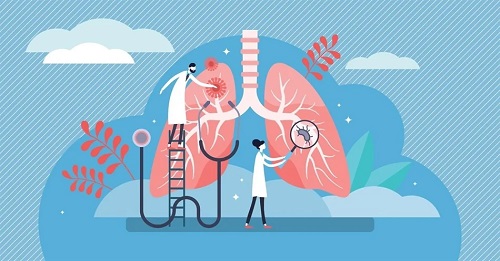 Ung thư phổi: Xạ trị và Hóa trị