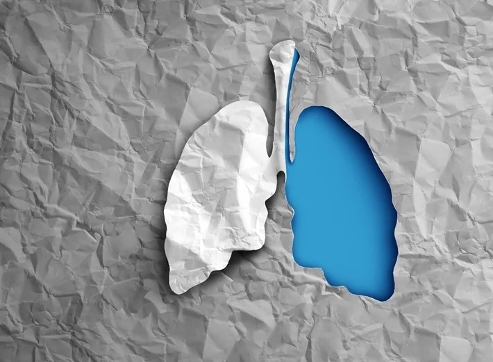 sự đa dạng trong bệnh ung thư phổi