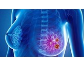 Cơ chế sinh học có thể kết nối ung thư vú và bệnh tiểu đường loại 2