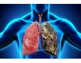 Nguyên nhân ung thư phổi