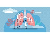 Ung thư phổi: Xạ trị và Hóa trị